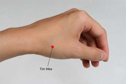 Ubicación exacta de Tim Mee en el dorso de la mano