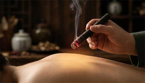Práctica de moxibustión con cigarro de moxa